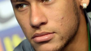 neymar cravos e espinhas